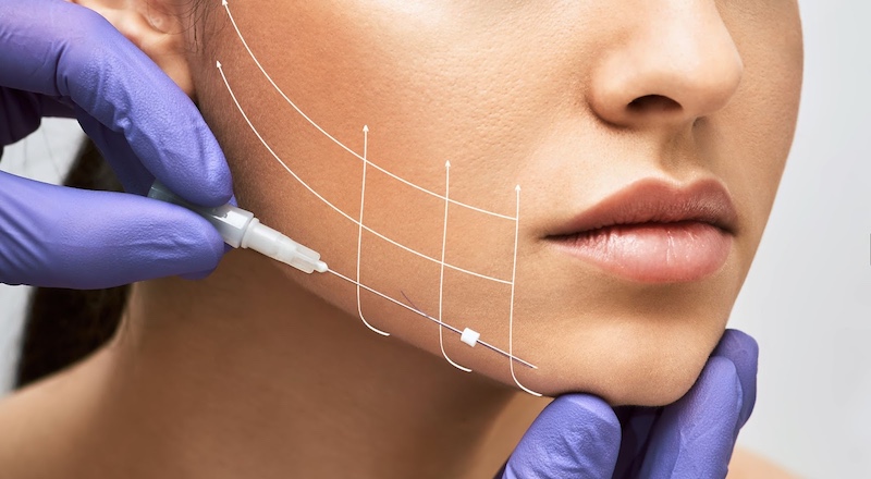 thread_cheek Thread cheek